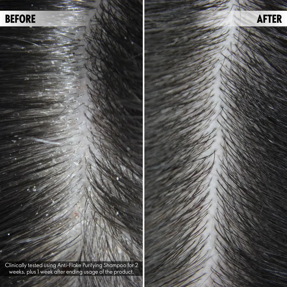 Anti-Flake Purifying Shampoo